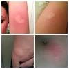 Learn about side effects, interactions and indications. 1