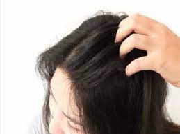 Pimples on scalp causes hair loss and its home remedies folliculitis is caused by a bacterial disease that results from an inflammation of hair follicles. Scalp Acne Can Be Painful And Irritating All You Need To Know About Its Prevention Treatment And Causes Health News Firstpost