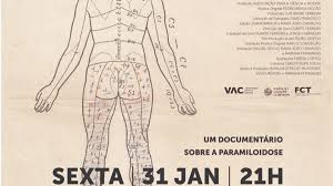 Insuficiência cardiaca e renal, etc. A Historia De Um Erro Documentario Sobre A Paramiloidose Exibido Pelo Centro Ciencia Viva De Lagos
