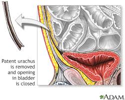 Image result for Umbilicus botryoides