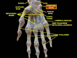Image result for Pisiform Bone