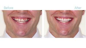 Victoria veytsman, owner of cosmetic dental studios, is one of the premier cosmetic and celebrity dentists in new york city. Cosmetic Dentistry Nyc Best Cosmetic Dentists In Nyc