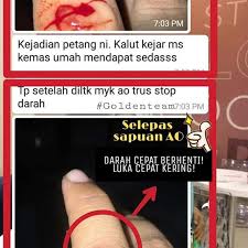 Luka terbuka lebih berisiko mengalami infeksi penyebab luka bernanah. Lukaringan Instagram Posts Photos And Videos Picuki Com