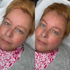 ✨✨ MICROBLADING OFFER ✨✨ £50 off Microblading and Combination brows  throughout November and December! Christmas preparations have begun 🎄 Book  now for smudge proof brows 24/7, and wake up with makeup 🎅🏼☃️⭐️ *