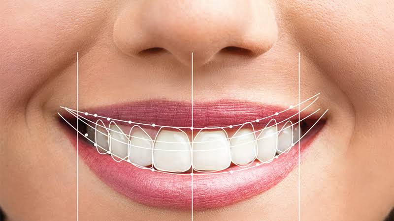 Smile Makeover/Designing product image