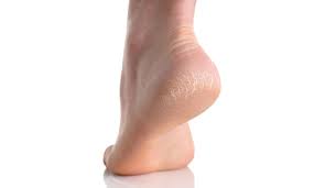 If you do not have coconut oil , you can substitute it with. Diy Essential Oil Foot Repair Lindsey Elmore
