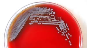 These bacteria can contaminate water. Melioidosis May Be Present In Nearly Half The World S Countries