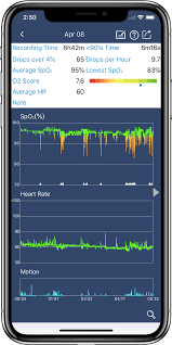 You need to be aware of these limitations when interpreting the result. Wellue O2ring Smart Ring Pulse Oximeter Overnight Tracking Wellue Health