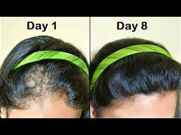 Simply, you warm up coconut oil until comfortable to touch. How To Get Long Thick Hair Remove For Head Hair Loss Re Hair Growth In Bald Area Lagu Mp3 Mp3 Dragon