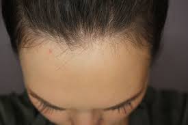 Ebooks and ebook visitors provide substantial benefits over traditional reading. How I Grew My Hair Back Post Partum Naturally And In One Month Justina S Gems Grow Hair Back Hair Lost Hair