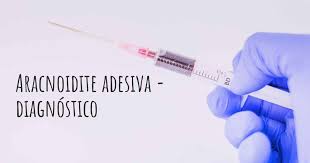 L'aracnoidite adesiva cronica è una condizione estremamente rara. Como Aracnoidite Adesiva E Diagnosticada