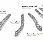 VariAx 2 Elbow Locking Plating System | Stryker