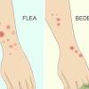 Bed bug infestations are increasingly common in new york city. Https Encrypted Tbn0 Gstatic Com Images Q Tbn And9gcq 39ewsdrvcy4cqom2ujbgguoohdkj1jbd5om Hbzdot4ynsti Usqp Cau