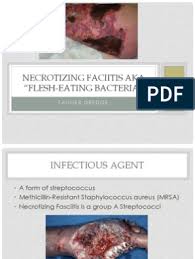 Program within @mayoclinicgradschool is currently accepting applications! Necrotizing Fasciitis