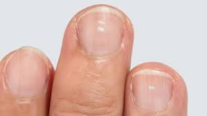 Maybe you would like to learn more about one of these? What The White Spots On Your Fingernails Reveal About Your Health White Spots On Nails White Spots On Fingernails Fingernail Health