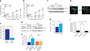 Check spelling or type a new query. Activation Of Trpc6 Channels Is Essential For Lung Ischaemia Reperfusion Induced Oedema In Mice Nature Communications