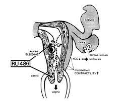 Effects of ru 486 on the progesterone receptor and on the expression of the uteroglobin gene. B1 1993 Ru 486 A Decade On Today And Tomorrow Clinical Applications Of Mifepristone Ru486 And Other Antiprogestins Assessing The Science And Recommending A Research Agenda The National Academies Press