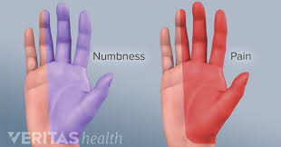 Masalah kebas tangan dan kaki ni seringkali berlaku pada setiap orang. Apa Punca Kejang Pada Tangan Yang Kerap Gunakan Komputer Perlu Tahu Untuk Elak Carpal Tunnel Syndrome Semua Semua Semuanya