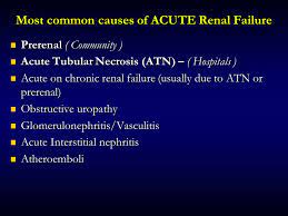 Doctors sometimes call it acute renal failure. Renal Failure Ppt Download