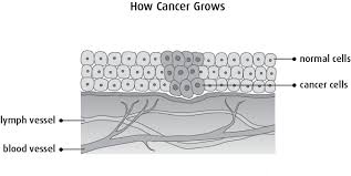 On the face, the appearance of this skin cancer can be quite varied. How Cancer Starts Grows And Spreads Canadian Cancer Society