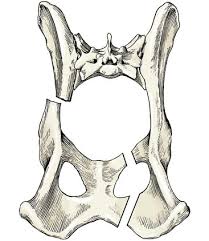 Anatomy of the lower urinary tract • anatomically,. Fractures Of The Pelvis Veterian Key