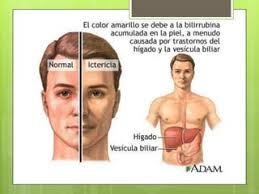 Higado capitulo 70 guyton y hall