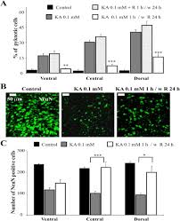 The assay involves a sensor array. Delayed Neuroprotection By Riluzole Against Excitotoxic Damage Evoked By Kainate On Rat Organotypic Spinal Cord Cultures Sciencedirect