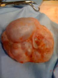 When touched, they feel like small circular or oval lumps under the skin. How Do You Know If A Cat Has Breast Cancer Virtuavet