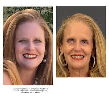 If you've been watching, waiting, sitting