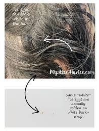 .hair #hairstyle #instahair #tagsforlikes #hairstyles #haircolour #haircolor #makeup #hairvideo braidideas #blonde #hairofinstagram #hairideas #coolhair #curly #hairs #hairup #frizzyhair #shine beautiful women head lices nits picking on black long silky hairs by mother | asmr pakistan. Jasper Gaynor Blog
