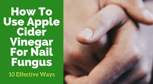 Make sure they sterilize all their tools after each use and before. Using Apple Cider Vinegar For Toenail Fungus 10 Diy Home Remedies