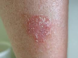 Células escamosas: las que forman la capa superficial de la epidermis.