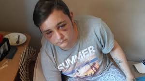 Dorian torturé à Fosses-la-Ville: jusqu'à 14 ans de prison, un des prévenus  en fuite!