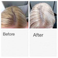 How To Fix Orange Roots Do 1 4 Honey To 1 Part Apple Cider Vinegar Leave On Hair For 2 Hours Wear A Shower Cap Rinse With Roots Hair Brassy Hair Hair Fixing