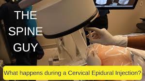 Image result for Lower Cervical Intramuscular Injection