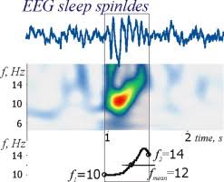Time Frequency Characteristics And Dynamics Of Sleep Spindles In Wag Rij Rats With Absence Epilepsy Sciencedirect