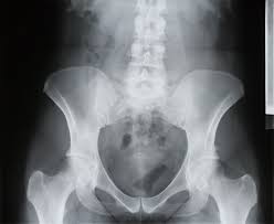 Do you know what bone cancer symptoms look like? How Caregivers Can Help Doctors Notice What S Wrong In An Aging Person