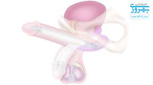 علت و علائم اختلال نعوظ در مردان چیست؟ • فیزیوتراپی بهروزی