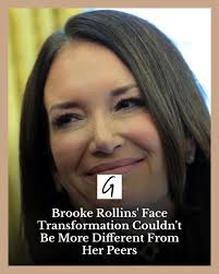 Here's what United States Secretary of Agriculture Brooke Rollins might  have had done to her face, per our plastic surgeon. (It's less than you'd  think.)