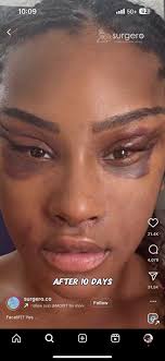 WORLDSTARHIPHOP ©️