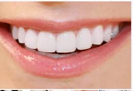 Răng Sứ Ceramill: Nguồn Gốc Và Ưu - Nhược Điểm Của Sứ Ceramill –  nhakhoavietnhat