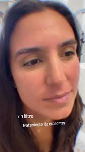 Aquí en zullylopezesthetic te embellecemos tu piel, tus cejas y pestañas  con más de 20 años de experiencia. Este mes de Junio tenemos nuevos  especiales y tratamientos ✨Aqui te esperamos! 🌸