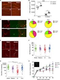 Lithium Treatment Reverses Irradiation Induced Changes In Rodent Neural Progenitors And Rescues Cognition Molecular Psychiatry
