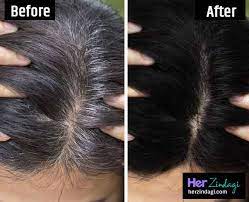 Personal Experience Natural Hair Colouring Techniques For White Hair In Hindi