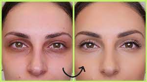 We did not find results for: How To Cover Dark Circles Under Eyes Dark Eyelids Blue Black Purple Eye Circles Youtube