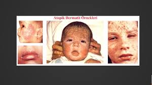 Değerli anne ve babalar, kafanızın karışık olması gayet tabiidir, çünkü konu zor ve geniş. Prof Dr Alisan Yildiran Ile Asi Gercekleri Video 2 Bolum Vitamingiller