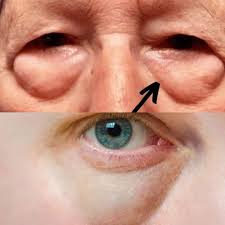 Barbara ONeill Health Tips