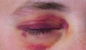 Pin On Maladies Symptomes Et Traitement