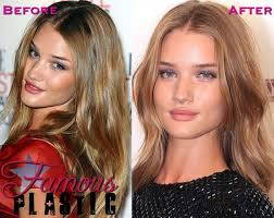 Rosie Huntington Whitely Had Plastic Surgery Nose Job Lip Injections Prominente Plastische Chirurgie Haarschonheit Wangenimplantate