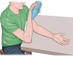Stopmijntennisarm.nu heeft een techniek ontwikkeld die een geweldig resultaat heeft bij deze vervelende en. Tennisarm Kraft Und Dehnubungen Gesundheitsinformation De